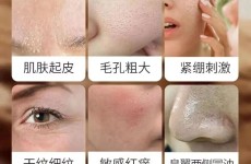 【健康科普】皮肤缺水怎么办？
