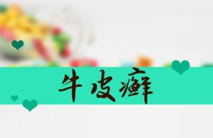 中国专家首次发现银屑病致病“元凶”