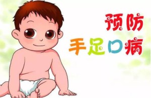 预防手足口病家长须知二十条