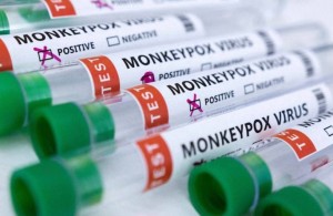 猴痘诊疗指南 （2022年版）