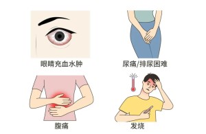 【健康科普】关于淋病，你不可不知的那些事儿