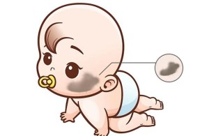 【健康科普】别让胎记成为孩子成长路上的“烦恼印”