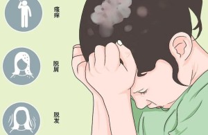 【健康科普】头癣