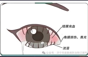 【健康科普】什么是倒睫？