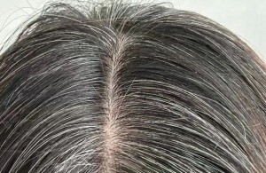 【健康科普】白头发的秘密
