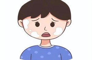 【健康科普】儿童白癜风科学认知与应对指南（上篇）