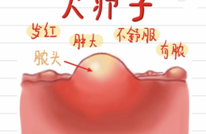 【护理日常】疥肿的识别与护理