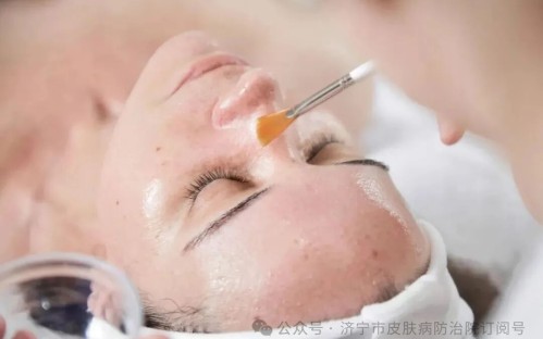 皮肤科医生谈“身体刷酸”：背部和上臂的焕肤指南