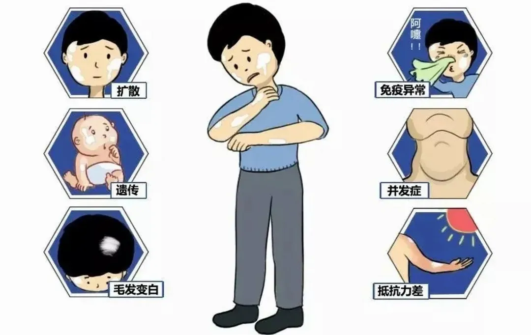 4ec1f531b5a8308cc62a94df1679aadc-sz_1138787