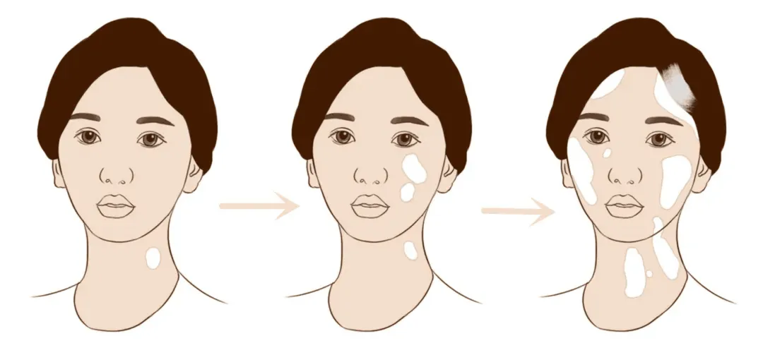 6d6b2a47a876d78581404b7e377d85cd-sz_932347